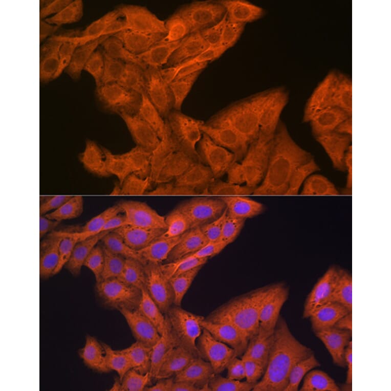 Immunofluorescence - Anti-SRP54 Antibody [ARC1904] (A308160) - Antibodies.com