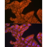 Immunofluorescence - Anti-SRP54 Antibody [ARC1904] (A308160) - Antibodies.com