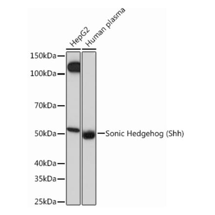 Western Blot - Anti-Sonic Hedgehog Antibody [ARC0701] (A308161) - Antibodies.com
