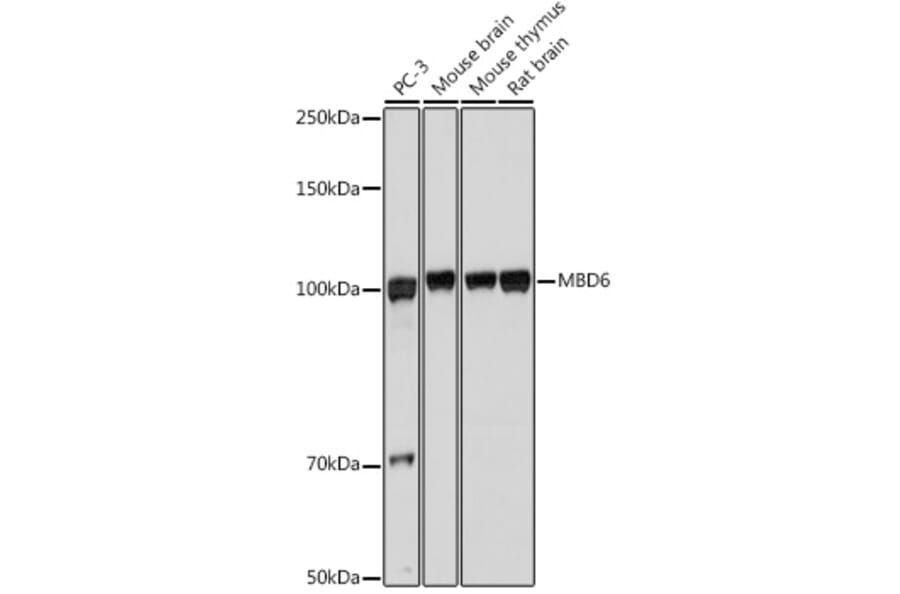 Western Blot - Anti-MBD6 Antibody (A308164) - Antibodies.com