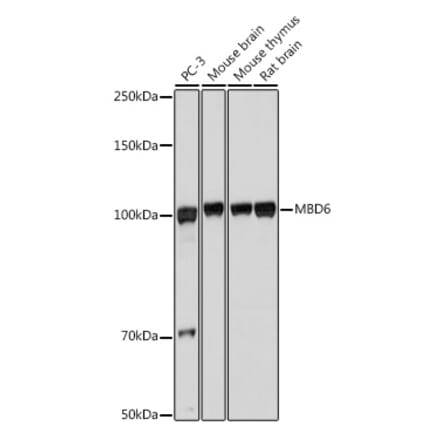 Western Blot - Anti-MBD6 Antibody (A308164) - Antibodies.com