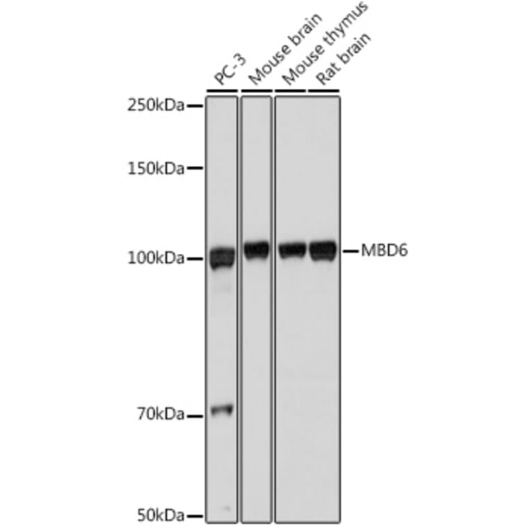 Western Blot - Anti-MBD6 Antibody (A308164) - Antibodies.com