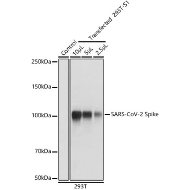 Western Blot - Anti-SARS-CoV-2 Spike Glycoprotein Antibody (A308165) - Antibodies.com