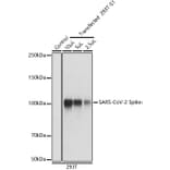 Western Blot - Anti-SARS-CoV-2 Spike Glycoprotein Antibody (A308165) - Antibodies.com