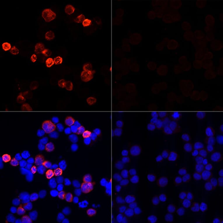Immunofluorescence - Anti-SARS-CoV-2 Spike Glycoprotein Antibody (A308165) - Antibodies.com
