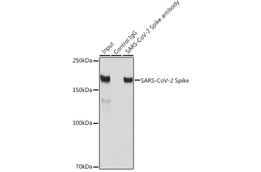 Western Blot - Anti-SARS-CoV-2 Spike Glycoprotein Antibody (A308165) - Antibodies.com