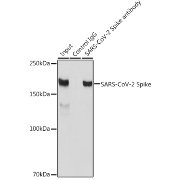 Western Blot - Anti-SARS-CoV-2 Spike Glycoprotein Antibody (A308165) - Antibodies.com