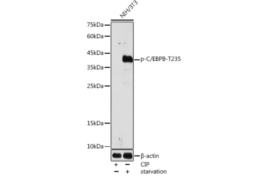 Western Blot - Anti-CEBP Beta (phospho Thr235) Antibody (A308166) - Antibodies.com