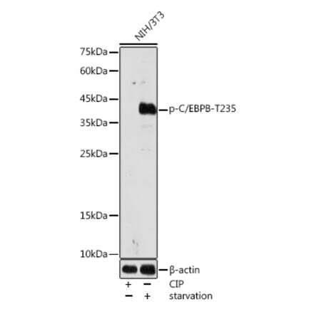 Western Blot - Anti-CEBP Beta (phospho Thr235) Antibody (A308166) - Antibodies.com