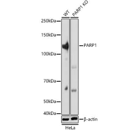 Western Blot - Anti-PARP1 Antibody (A308167) - Antibodies.com
