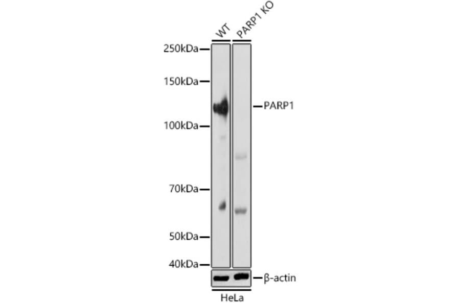 Western Blot - Anti-PARP1 Antibody (A308167) - Antibodies.com