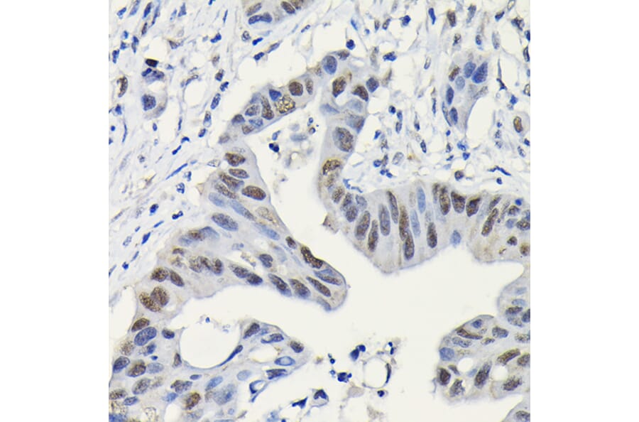 Immunohistochemistry - Anti-PARP1 Antibody (A308167) - Antibodies.com
