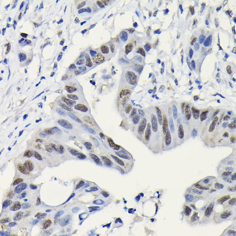 Immunohistochemistry - Anti-PARP1 Antibody (A308167) - Antibodies.com