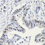 Immunohistochemistry - Anti-PARP1 Antibody (A308167) - Antibodies.com