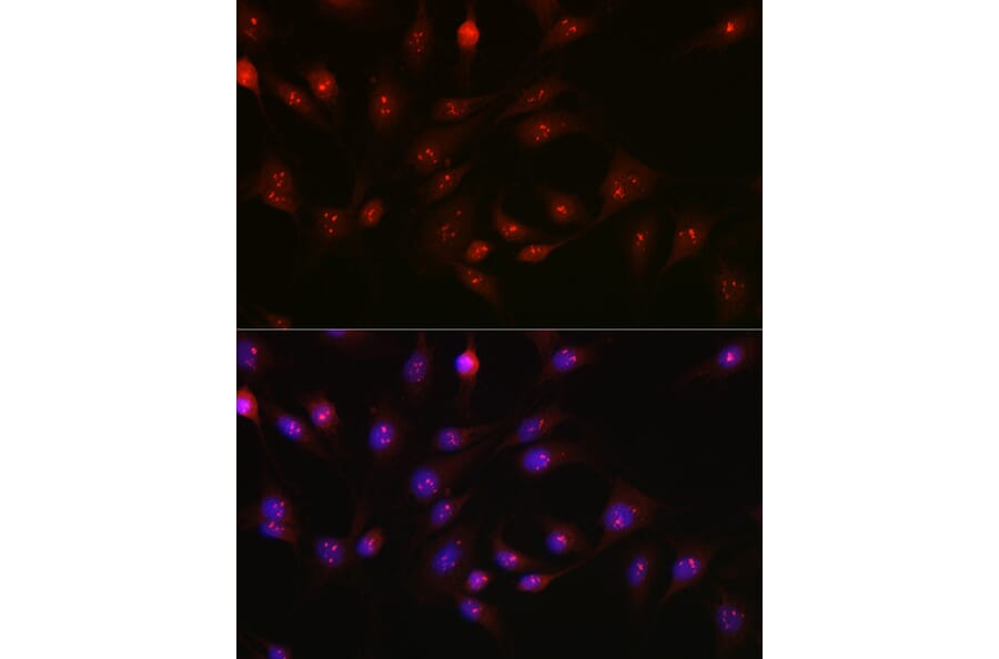 Immunofluorescence - Anti-PARP1 Antibody (A308167) - Antibodies.com