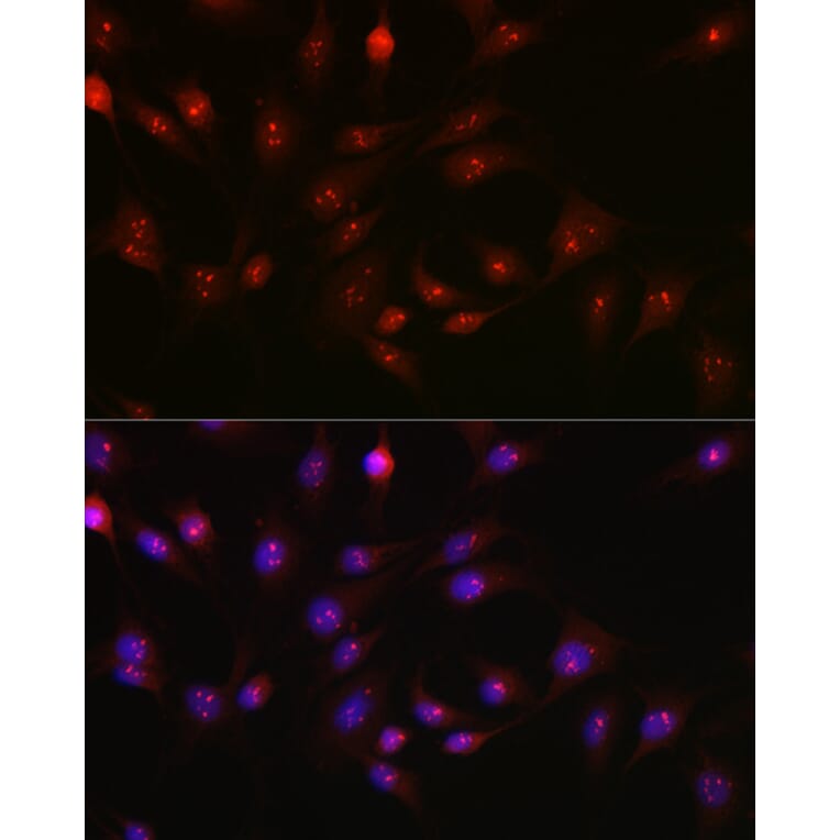 Immunofluorescence - Anti-PARP1 Antibody (A308167) - Antibodies.com