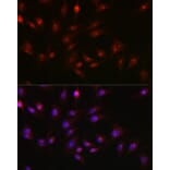 Immunofluorescence - Anti-PARP1 Antibody (A308167) - Antibodies.com