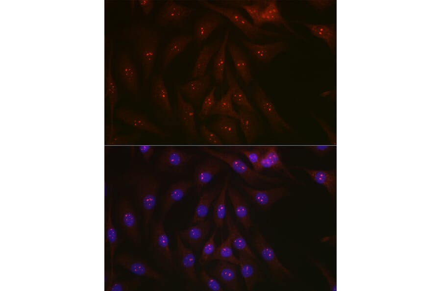 Immunofluorescence - Anti-PARP1 Antibody (A308167) - Antibodies.com