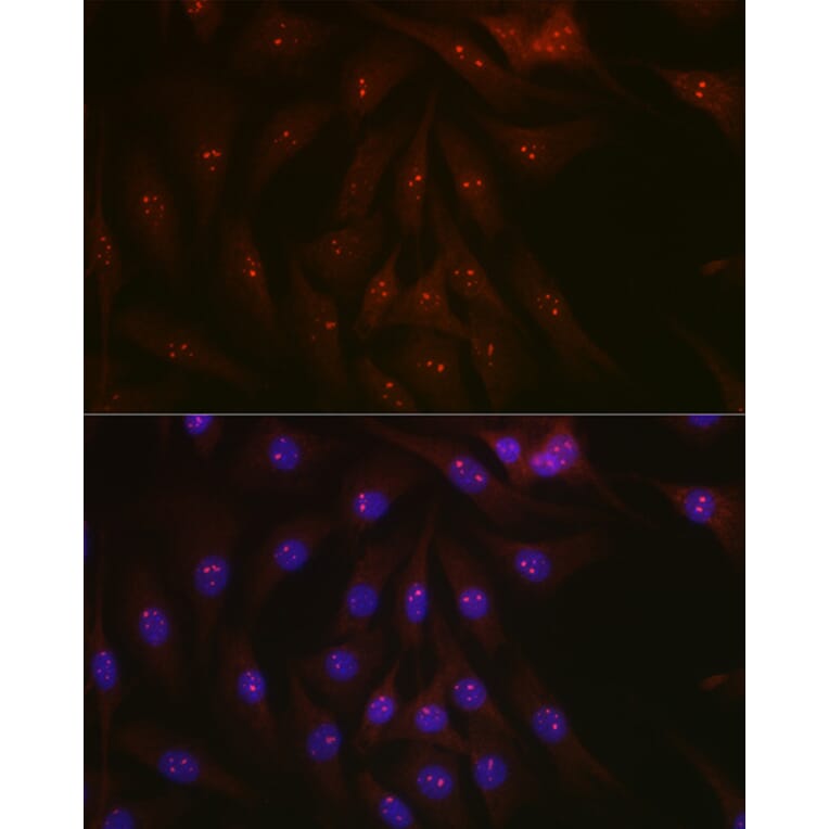 Immunofluorescence - Anti-PARP1 Antibody (A308167) - Antibodies.com