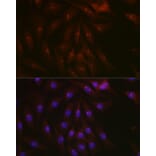 Immunofluorescence - Anti-PARP1 Antibody (A308167) - Antibodies.com