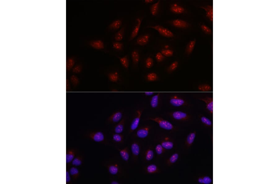 Immunofluorescence - Anti-PARP1 Antibody (A308167) - Antibodies.com