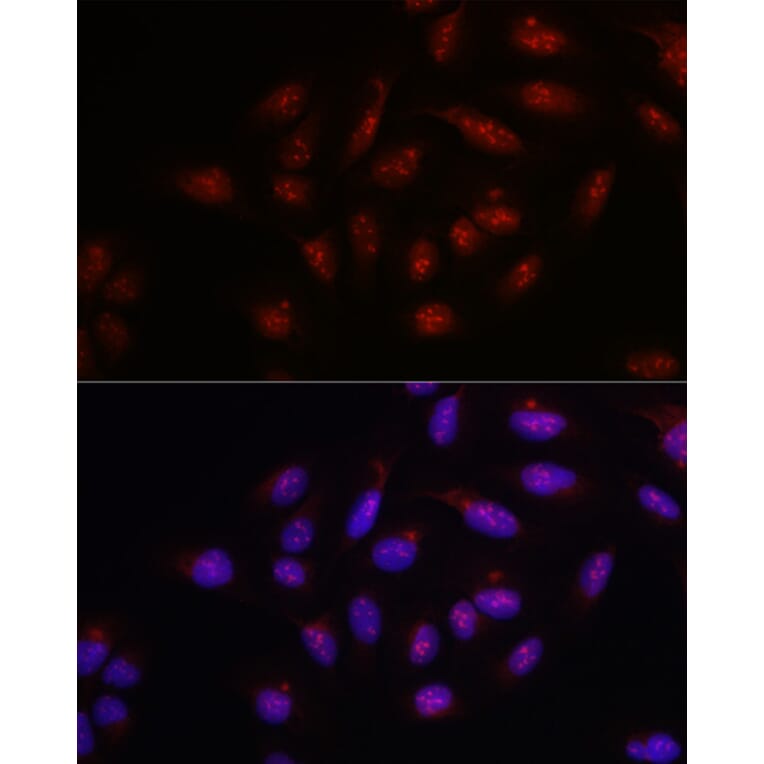 Immunofluorescence - Anti-PARP1 Antibody (A308167) - Antibodies.com