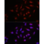 Immunofluorescence - Anti-PARP1 Antibody (A308167) - Antibodies.com