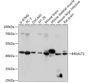 Western Blot - Anti-B4GALT3 Antibody (A308168) - Antibodies.com