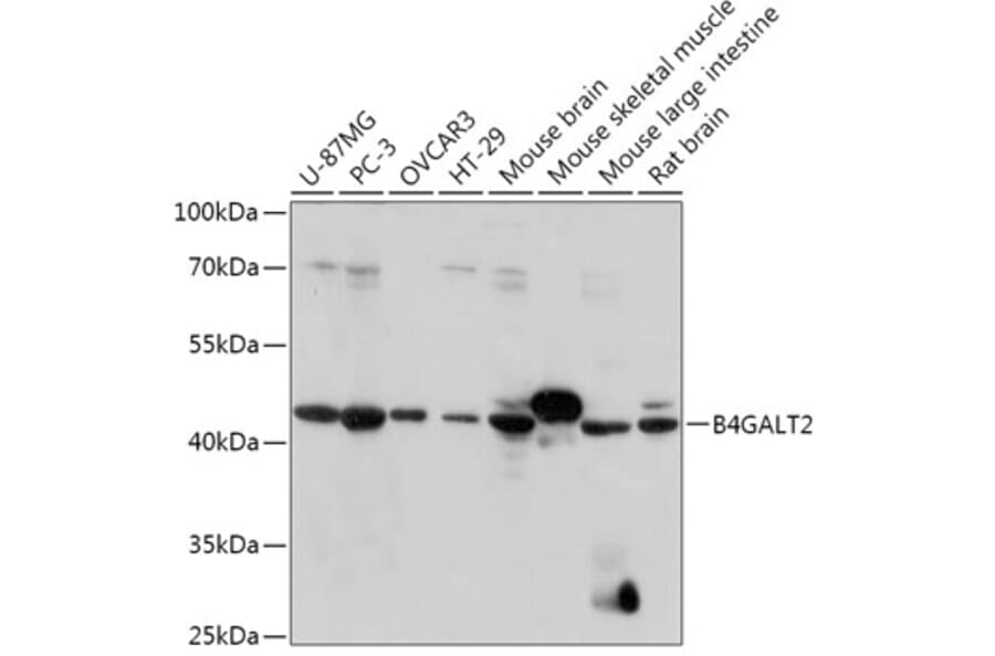 Western Blot - Anti-B4GALT3 Antibody (A308168) - Antibodies.com