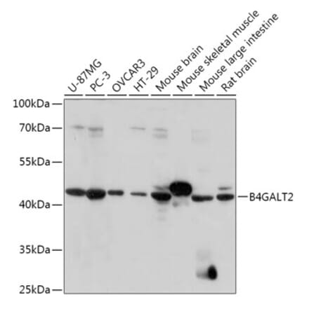 Western Blot - Anti-B4GALT3 Antibody (A308168) - Antibodies.com