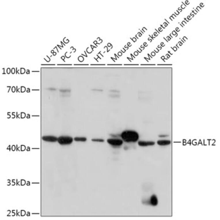 Western Blot - Anti-B4GALT3 Antibody (A308168) - Antibodies.com