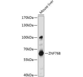 Western Blot - Anti-ZNF768 Antibody (A308169) - Antibodies.com