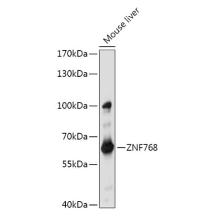 Western Blot - Anti-ZNF768 Antibody (A308169) - Antibodies.com