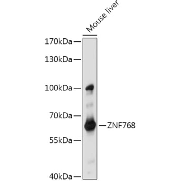 Western Blot - Anti-ZNF768 Antibody (A308169) - Antibodies.com