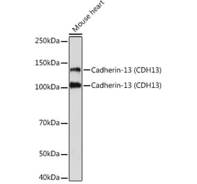 Western Blot - Anti-H Cadherin Antibody [ARC1931] (A308170) - Antibodies.com