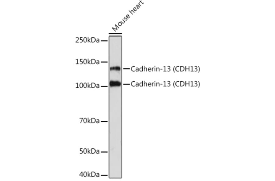 Western Blot - Anti-H Cadherin Antibody [ARC1931] (A308170) - Antibodies.com
