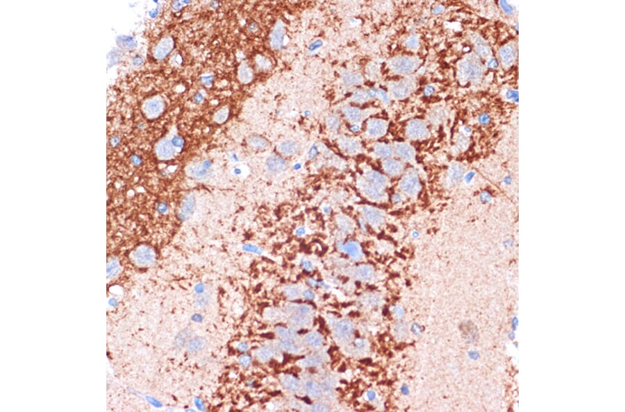 Immunohistochemistry - Anti-H Cadherin Antibody [ARC1931] (A308170) - Antibodies.com