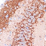 Immunohistochemistry - Anti-H Cadherin Antibody [ARC1931] (A308170) - Antibodies.com