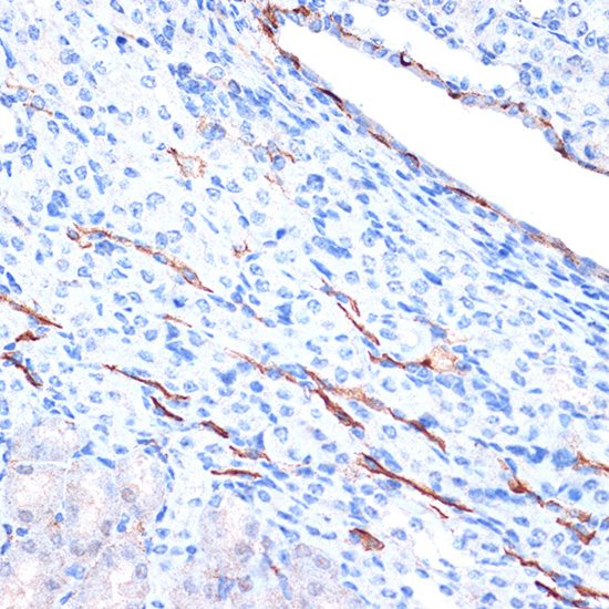 Immunohistochemistry - Anti-H Cadherin Antibody [ARC1931] (A308170) - Antibodies.com