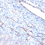 Immunohistochemistry - Anti-H Cadherin Antibody [ARC1931] (A308170) - Antibodies.com