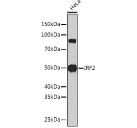Western Blot - Anti-IRF2 Antibody [ARC0265] (A308172) - Antibodies.com