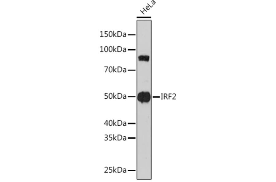 Western Blot - Anti-IRF2 Antibody [ARC0265] (A308172) - Antibodies.com