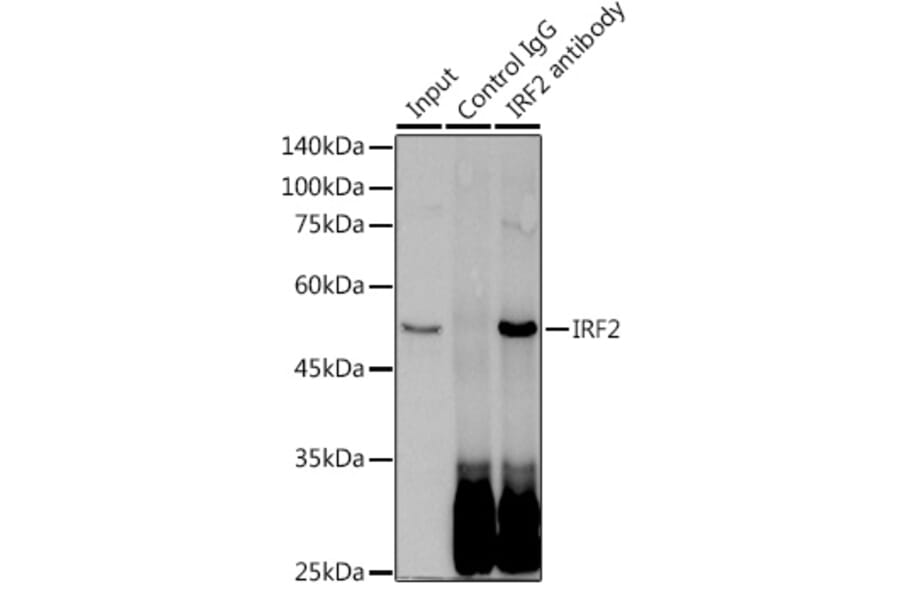 Western Blot - Anti-IRF2 Antibody [ARC0265] (A308172) - Antibodies.com