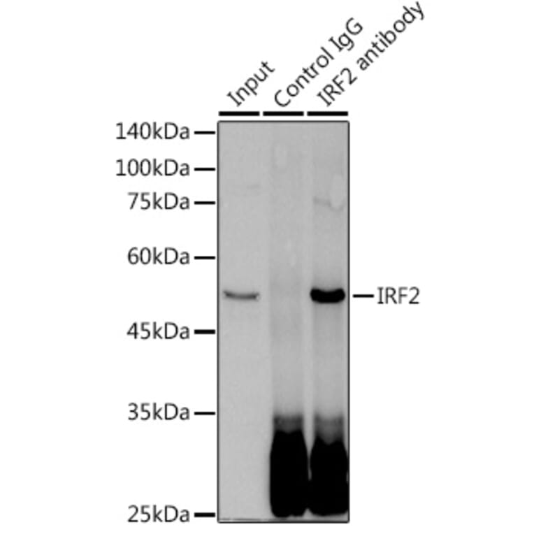 Western Blot - Anti-IRF2 Antibody [ARC0265] (A308172) - Antibodies.com