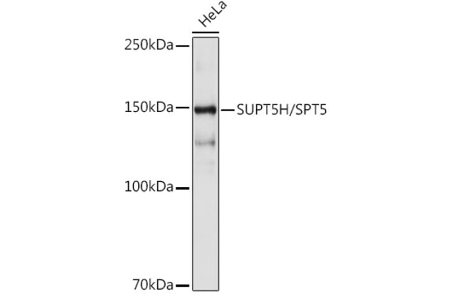 Western Blot - Anti-SPT5 Antibody [ARC2380] (A308173) - Antibodies.com
