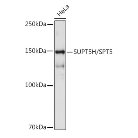 Western Blot - Anti-SPT5 Antibody [ARC2380] (A308173) - Antibodies.com