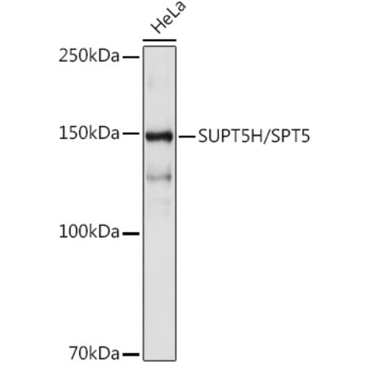 Western Blot - Anti-SPT5 Antibody [ARC2380] (A308173) - Antibodies.com