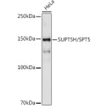 Western Blot - Anti-SPT5 Antibody [ARC2380] (A308173) - Antibodies.com