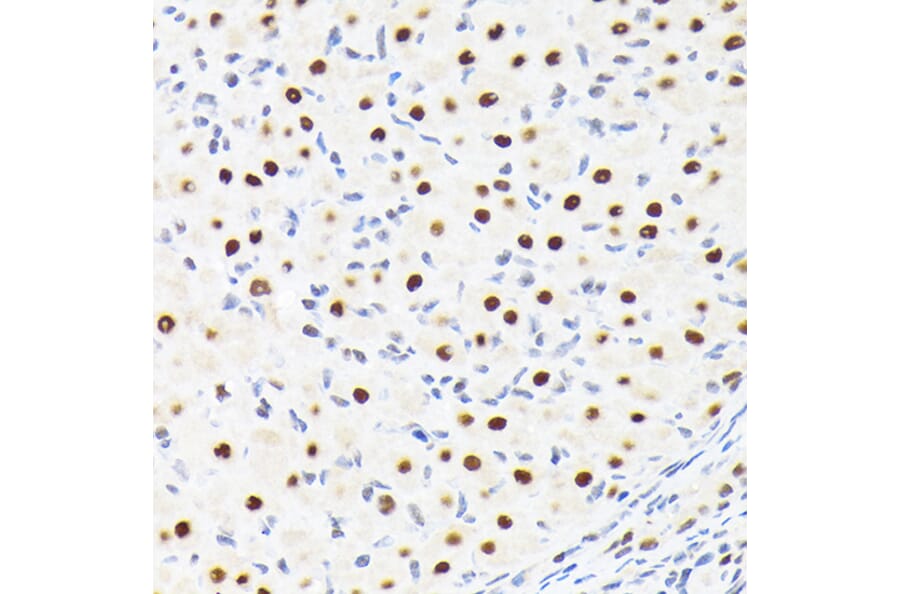 Immunohistochemistry - Anti-SPT5 Antibody [ARC2380] (A308173) - Antibodies.com