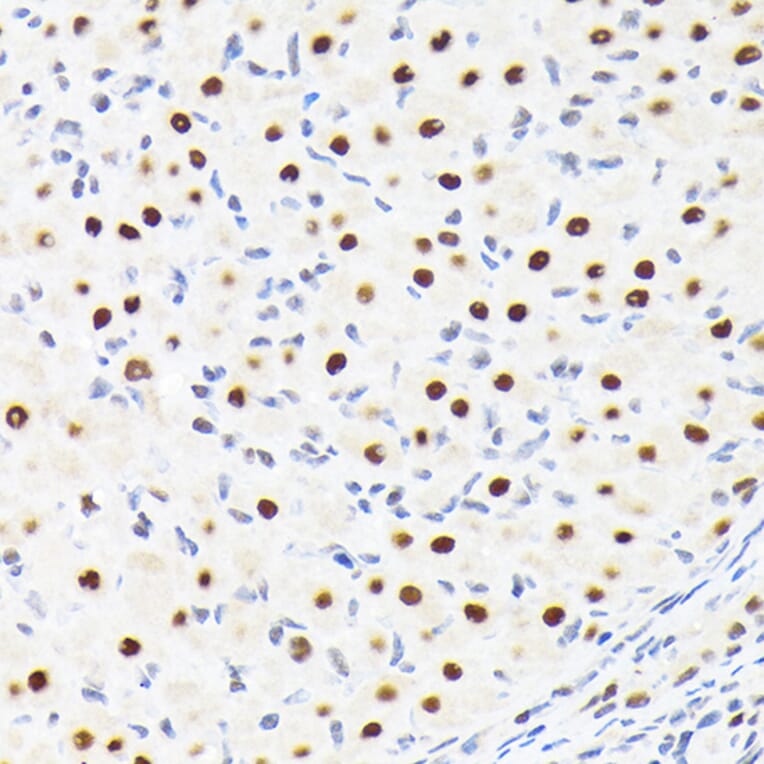 Immunohistochemistry - Anti-SPT5 Antibody [ARC2380] (A308173) - Antibodies.com